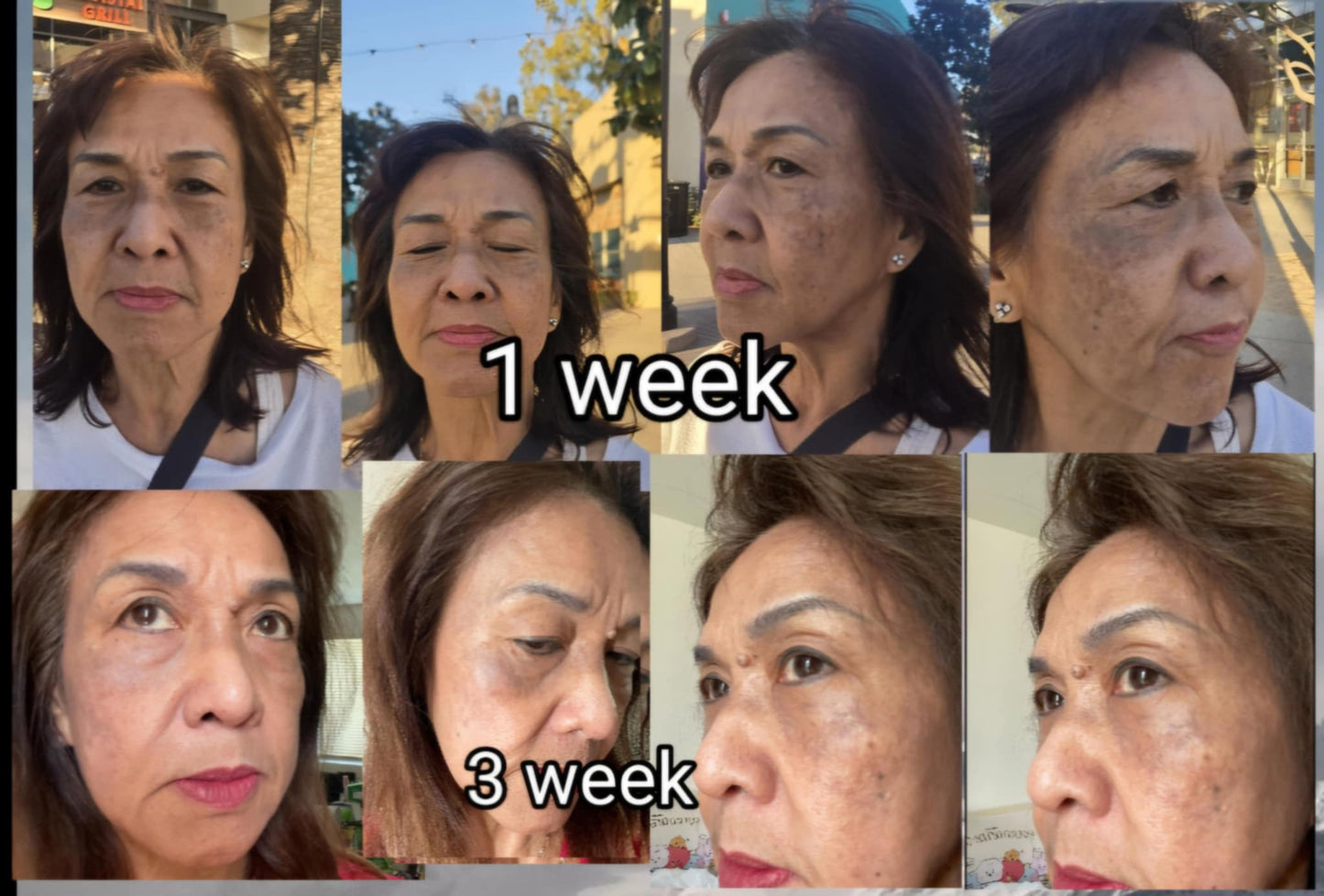 ChanVida | Whitening Facial Cream