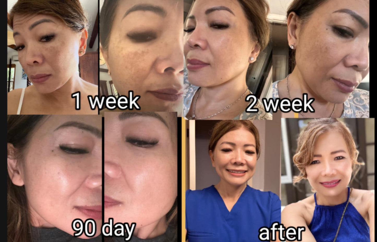 ChanVida | Whitening Facial Cream